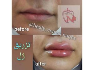 19 - beauty_center_narjes-6