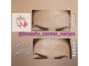 21 - beauty_center_narjes-25