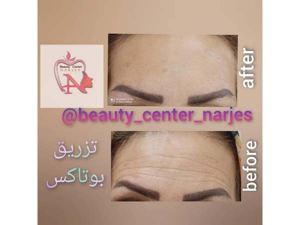 21 - beauty_center_narjes-25