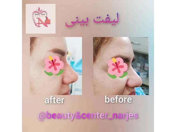 22 - beauty_center_narjes-24