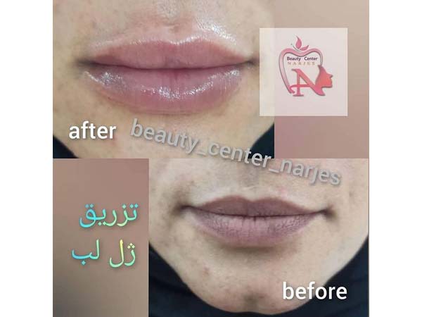 25 - beauty_center_narjes-13