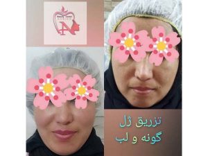 26 - beauty_center_narjes-23