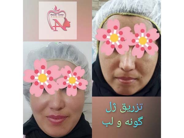 26 - beauty_center_narjes-23