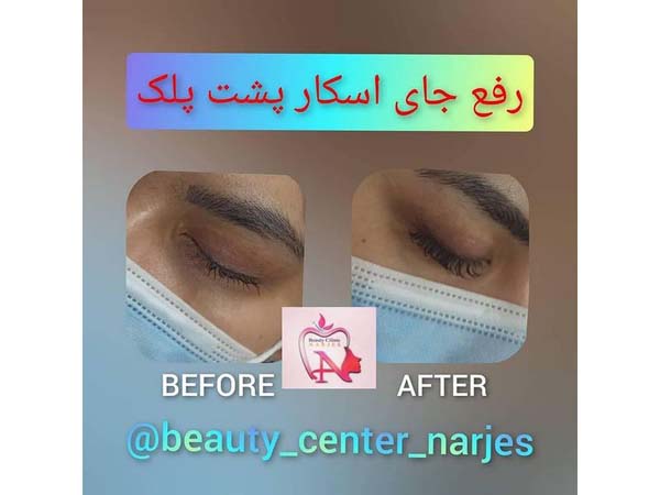 27 - beauty_center_narjes-10
