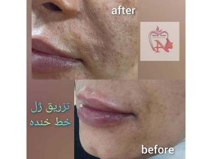 29 - beauty_center_narjes-12