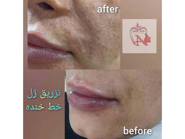 29 - beauty_center_narjes-12