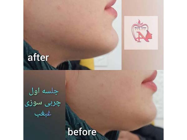 31 - beauty_center_narjes-5