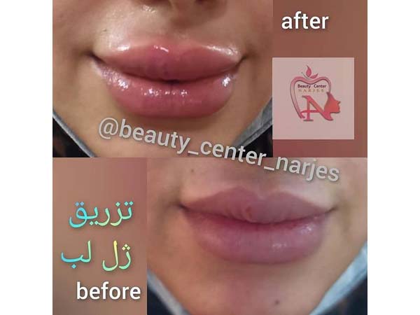 32 - beauty_center_narjes-7
