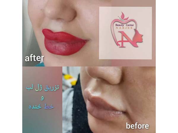 34 - beauty_center_narjes-29