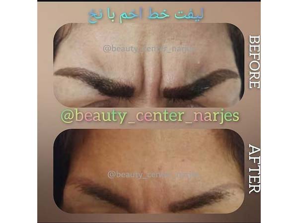 39 - beauty_center_narjes-11