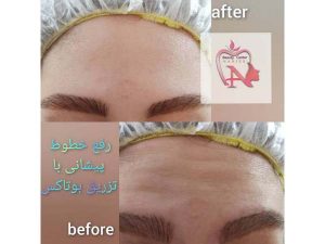 40 - beauty_center_narjes-28