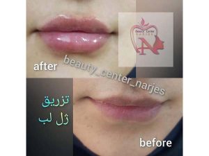 41 - beauty_center_narjes-14