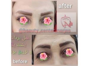 42 - beauty_center_narjes-26