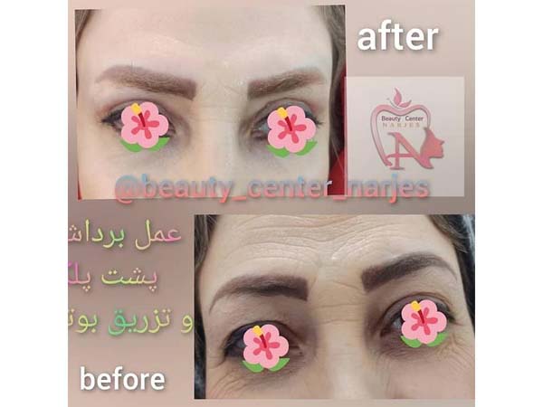 42 - beauty_center_narjes-26