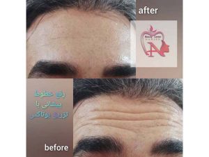 43 - beauty_center_narjes-27