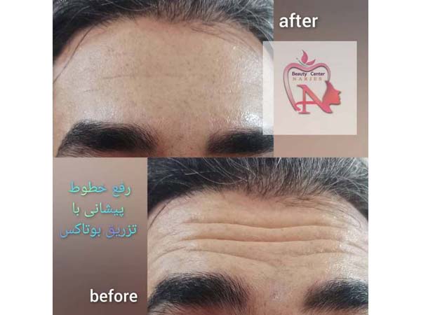 43 - beauty_center_narjes-27