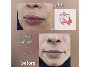 47 - beauty_center_narjes-30