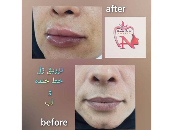 47 - beauty_center_narjes-30