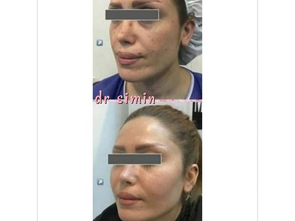 16 - beautyclinic_dr_simin-1