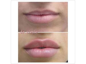 17 - beautyclinic_dr_simin-14