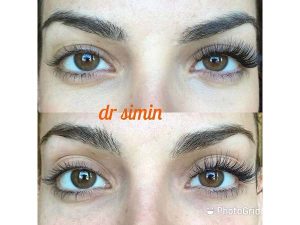 18 - beautyclinic_dr_simin-13
