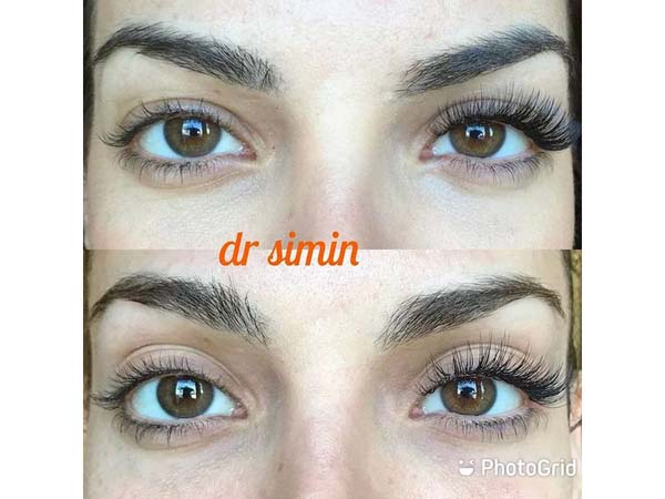 18 - beautyclinic_dr_simin-13