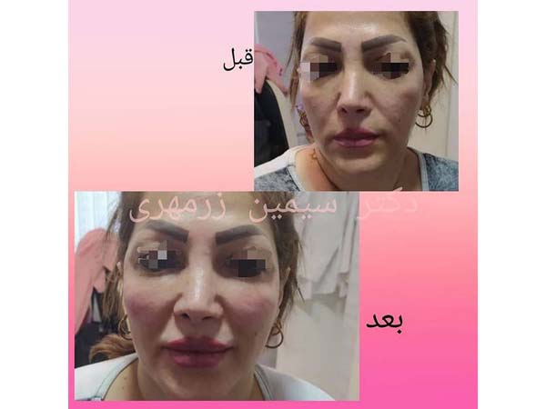 19 - beautyclinic_dr_simin-5