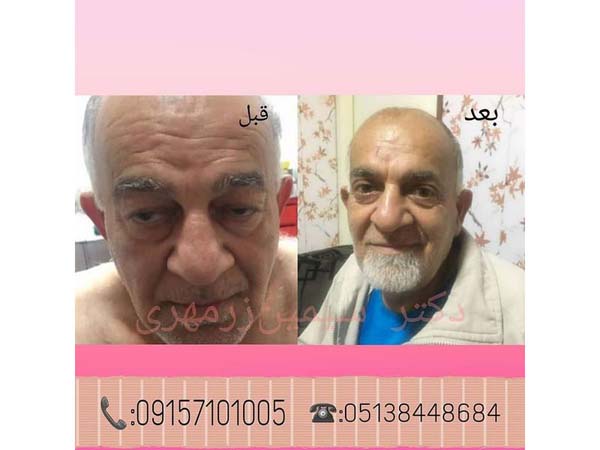 20 - beautyclinic_dr_simin-9