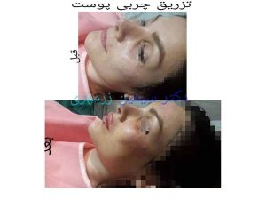 21 - beautyclinic_dr_simin-10