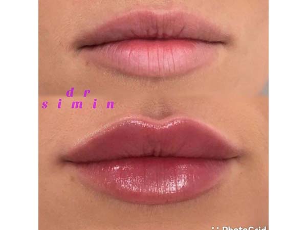 22 - beautyclinic_dr_simin-3