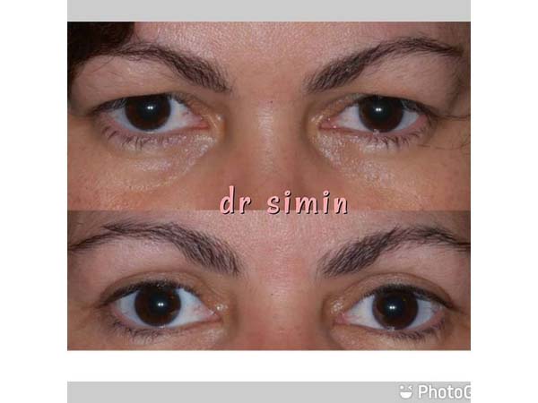 24 - beautyclinic_dr_simin-4