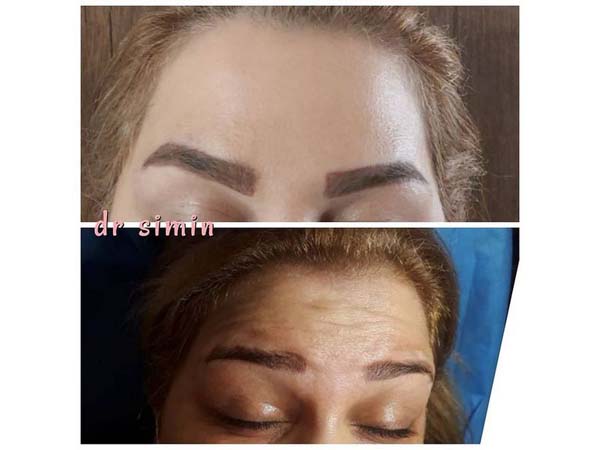 27 - beautyclinic_dr_simin-2