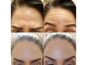 28 - beautyclinic_dr_simin-12