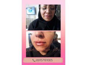 29 - beautyclinic_dr_simin-6