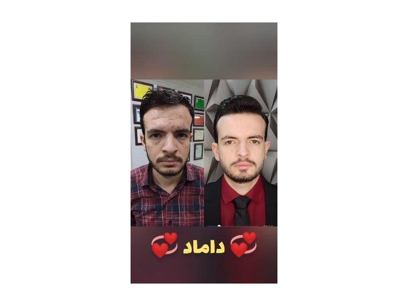 1 (7)